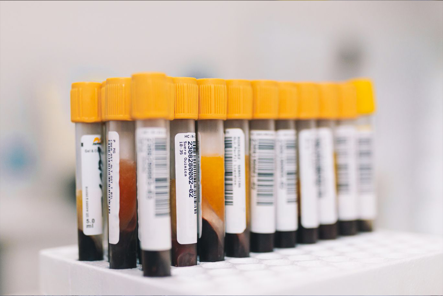 DSC_0493-scaled (1)f